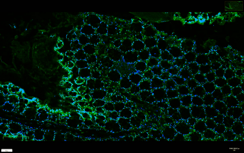 KLF4 (PT0167R) PT® Rabbit mAb