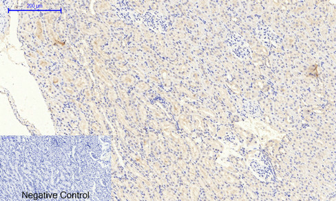 JAK2 (Phospho Tyr1007) Rabbit pAb