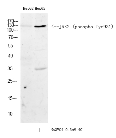JAK2 (Phospho Tyr931) Rabbit pAb