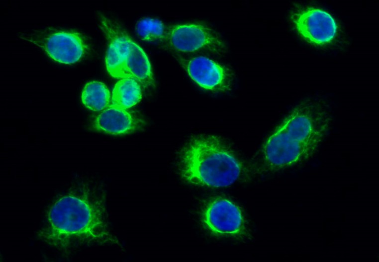 JAK3 (PT0405R) PT® Rabbit mAb
