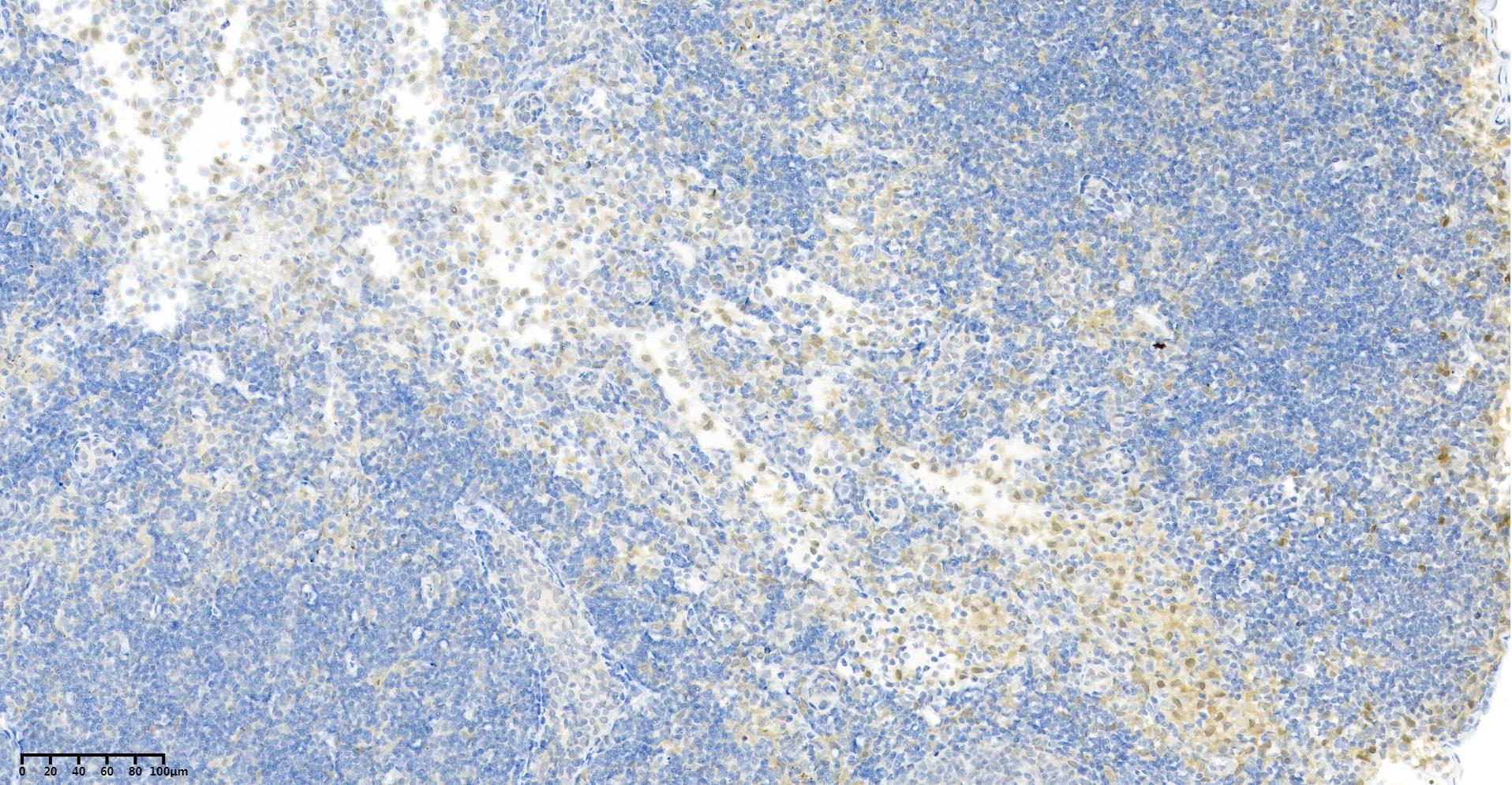 p38 (PT0436R) PT® Rabbit mAb