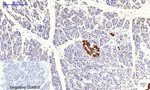 JAK1 (phospho Tyr1034) Polyclonal Antibody