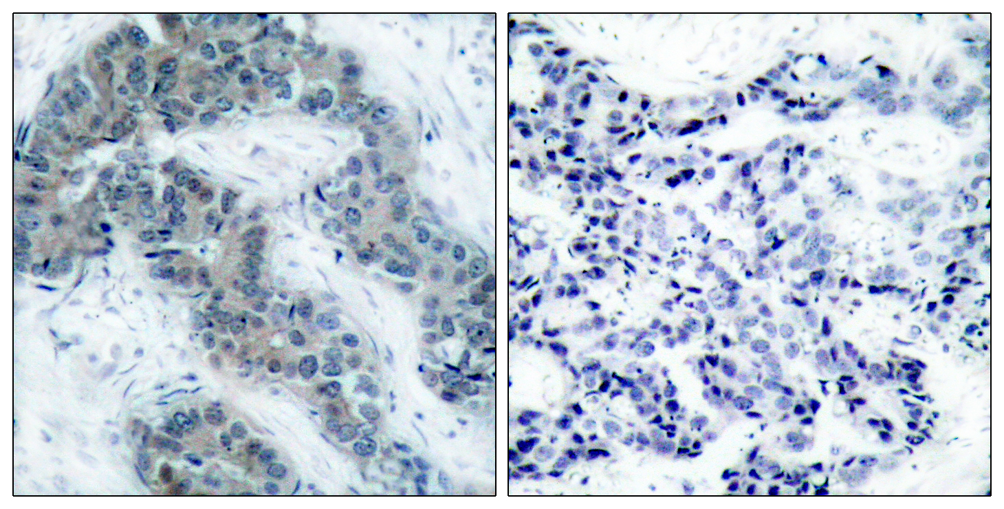 JAK2 (Phospho Tyr1007) Rabbit pAb
