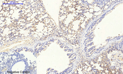 JAK2 (Phospho Tyr1007) Rabbit pAb
