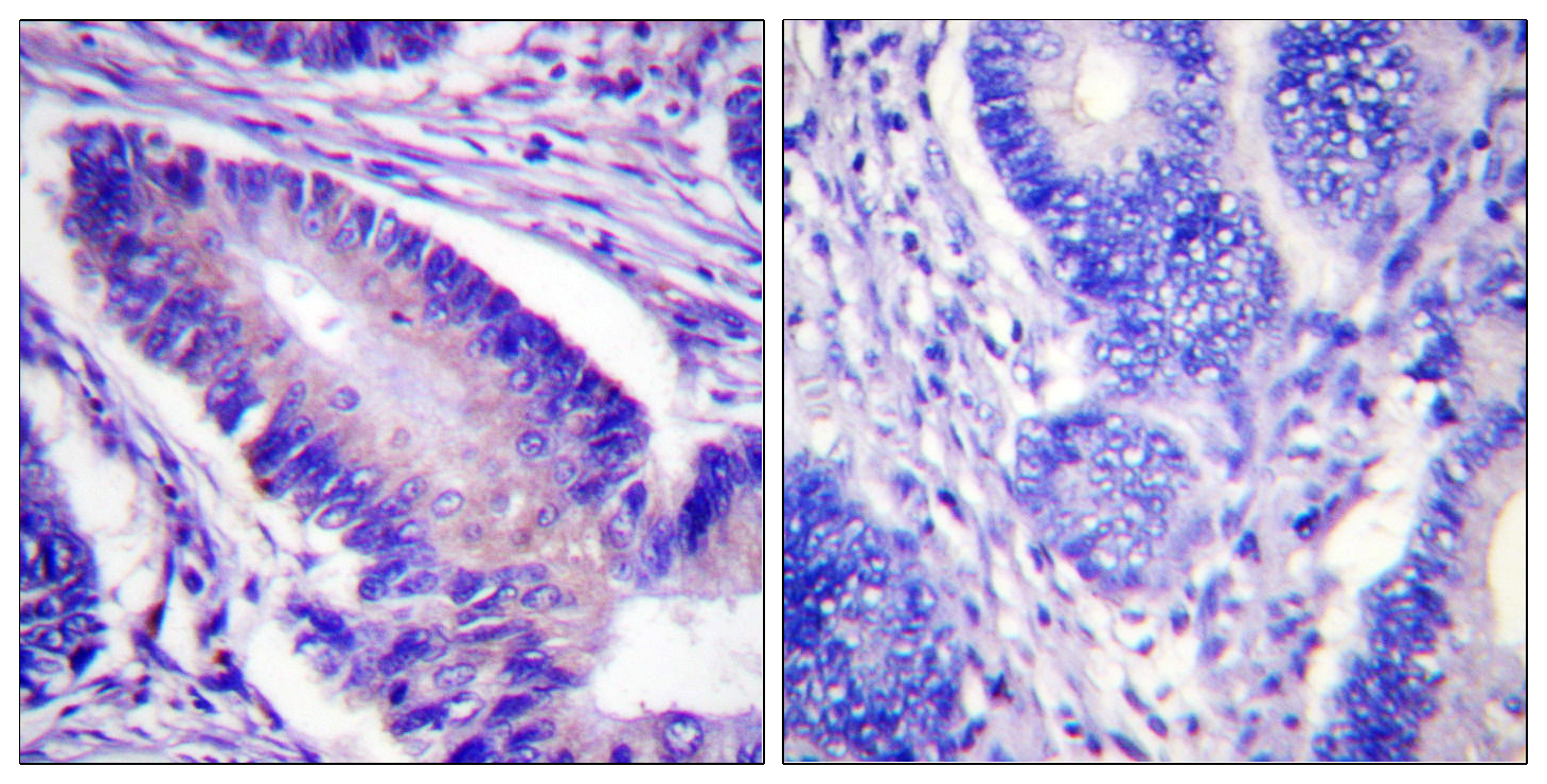 eIF4B (Phospho Ser422) Rabbit pAb