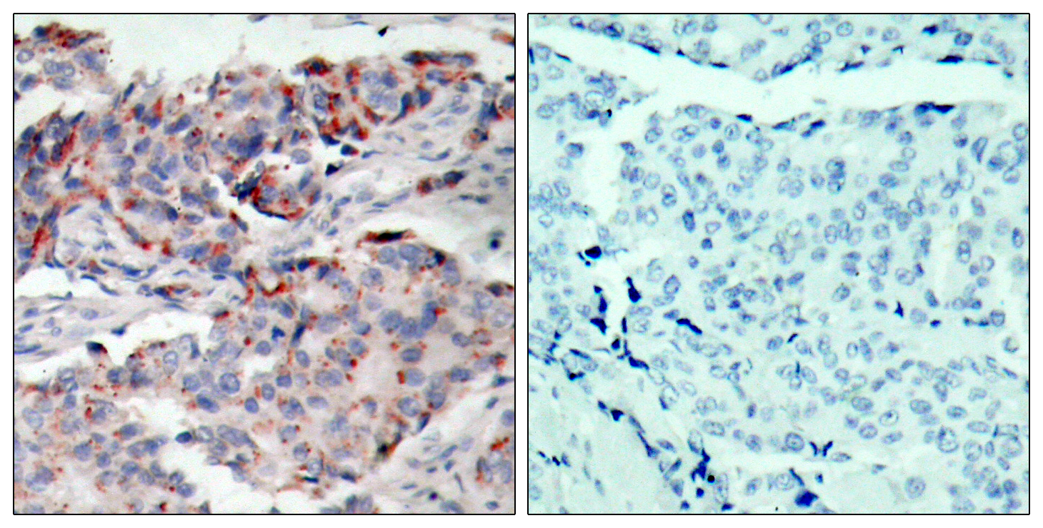 JAK2 (Phospho Tyr221) Rabbit pAb