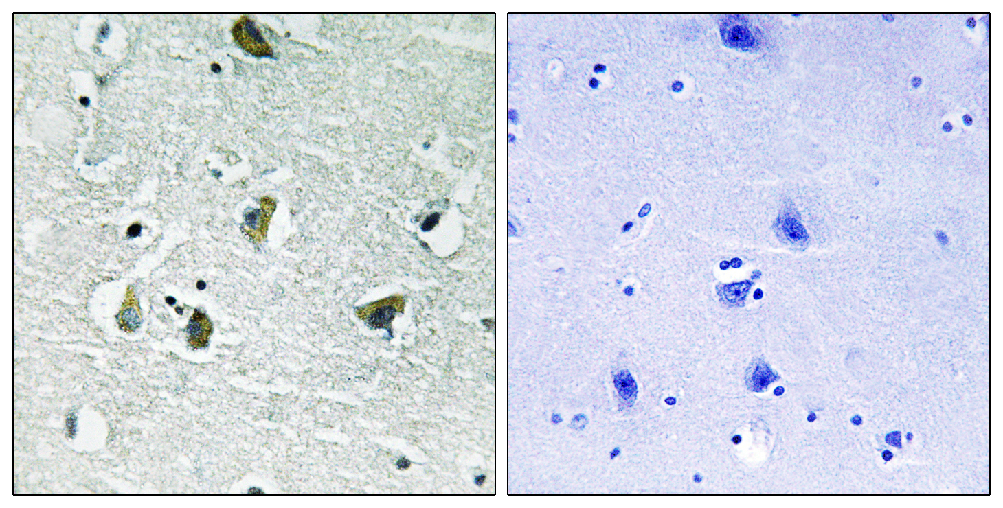 JAK2 (Phospho Tyr931) Rabbit pAb