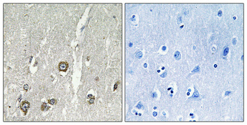 ACOT8 Rabbit pAb
