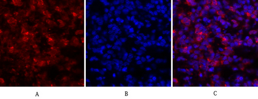 JAK1 (PT0658R) PT® Rabbit mAb
